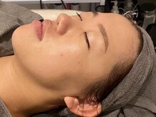 ラルミエール 緑店はなれ(la lumiere)/贅沢スペシャルコース