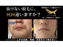 ジェントル 三宮