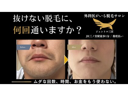 ジェントル 三宮の写真
