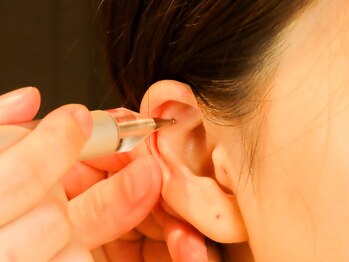 ソアム(Soame)の写真/初めての方大歓迎☆貼るだけでキュッと小顔リフト！耳つぼジュエリーで気になる肩こりや不調を本格ケア！