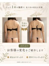 リンガ(Ringa)/1回で実感すっきり背中