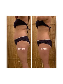 フラウラ(Fraula)/インディバでこの変化を実感！