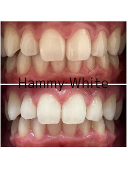 ハミーホワイト(Hammy White)/一度でこの白さ!