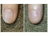 HAND【深爪改善】ウェットケア+フィルイン★クリア ￥8,000→