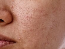 アンドアンド(&and)/全体的にくすんだお肌にも◎