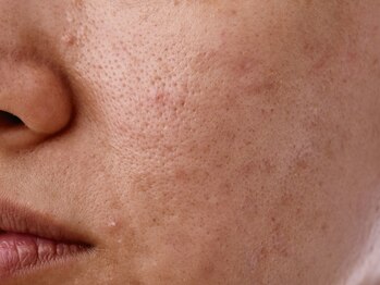 アンドアンド(&and)/全体的にくすんだお肌にも◎