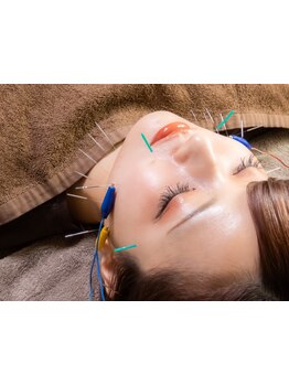 小顔になりたい