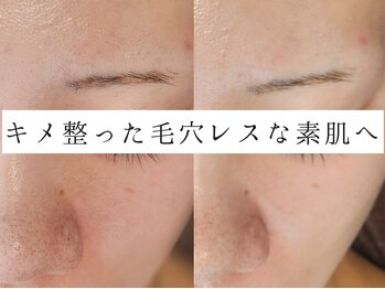 ユウビジン(YOU美人)/