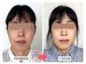 【火曜日限定】スキマ時間に小顔矯正☆キレイをキープ≪初回は所要時間60分≫