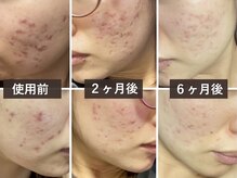 ナチュラーレ 天王寺店(Naturale)