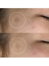 ラウレア(Laule'a)/津山｜シミくすみ肌トーンアップ