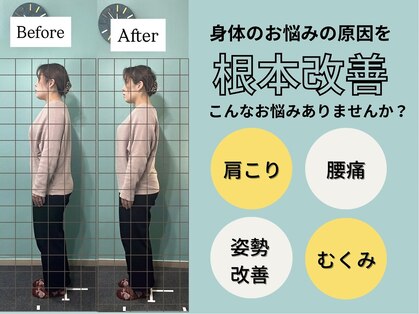 ハチ(HACHI)の写真