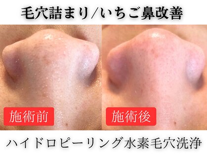 クリオ(Crio)の写真