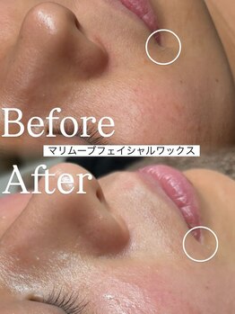 リープ 桑名(lieb)の写真/フェイシャルワックスで素肌を整え、理想の肌質改善を叶える癒やしの空間です★オイルリンパ付ケアです