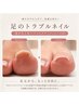 【フット】足のトラブルネイル→巻き爪ケア1本+フットケア10本◆フットバス付