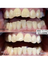 ビーバイビー(BBYB)/初回トライアルの実例♪