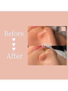 クリアラボ 豊中(Clear Lab)/Before&After