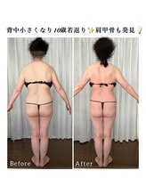 シュシュ エステティックアンドヨガ(chouchou esthetique&yoga)/３週に1回ペースで１年間の結果