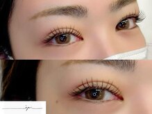 エピ(epi)/マツエク