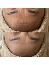 ウルス(ulus)/アンストレス＋ポレーション導入