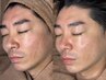【水光うるツヤ肌】韓国美肌管理No.1/ララピール第4世代ピーリング　￥13500