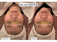 トワヒーリング(toihealing)/スキンケアフェイシャルワックス