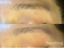 シードリン(Seedling)/ブロウラミネーション