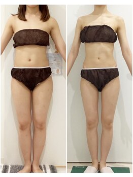 ビューティーサロン シンデレラ 心斎橋本店(Cinderella)の写真/【最速最短で痩せたいなら☆シンデレラ痩身】「早く結果を出したい!」を叶える結果重視の本格痩身サロン