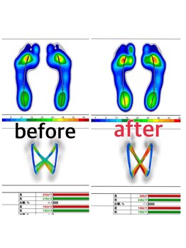 メディカルジャパン 吉祥寺/歩き方は変わります!