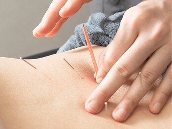 サボテン接骨院 はりきゅう院 浦和駅東口院(SABO-TEN接骨院 はりきゅう院)/繰り返す腰痛に