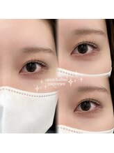 アルーマ アイ(allma.eye)/上下まつ毛パーマ　まつ毛パーマ