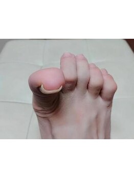 爪の悩みを解消できる（ケア含む）