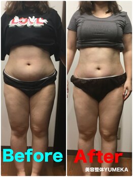 美容整体ユメカ(美容整体YUMEKA)/骨盤ダイエット+骨盤ストレッチ