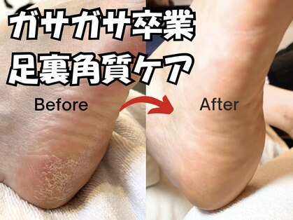 プラスワン(+1)の写真