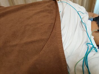 鍼灸院凪/カリム(Calme)/施術風景