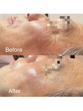 エー(A)/男性も綺麗に