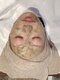 ミアボーテ(MIA BEAUTE)の写真/本格ケアで年齢に負けない肌へ！貴方のお肌悩みに合わせて施術をご提案します◎お気軽にお越しください◎