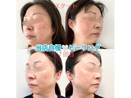 ミコ(Mico)の写真