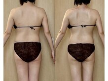 モモリラ(momorila)の雰囲気（新感覚！吸われてスッキリ♪活性リンパ洗浄◎お得なクーポンあり）