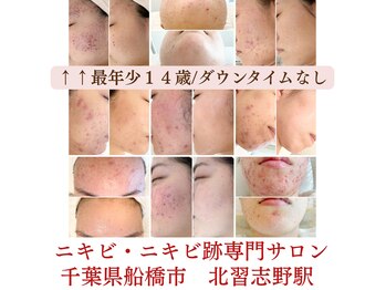 ペシュア(pecheA)