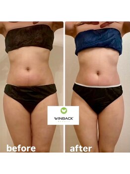 シエルエトワール 唐津店(Ciel Etoile)/WINBACK90分　お腹美脚　1回