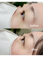 シュエット(chouette)/before/after