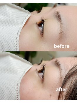 シュエット(chouette)/before/after