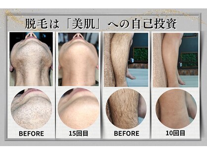 レイ(R.E.I)の写真