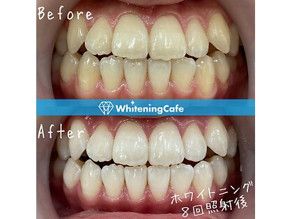 ホワイトニングカフェ 吉祥寺店(WhiteningCafe)の写真