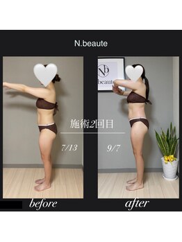 エヌボーテ(N. beaute)/大人気!下半身コース!