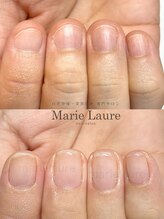マリーロール 淀屋橋本店(Marie Laure)/自爪育成/深爪矯正/ネイルケア