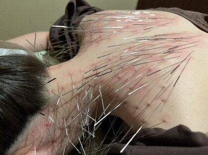 オリエントセラピー(ORIENT THERAPY)の写真