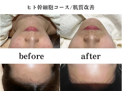 リンフェイス 高松店(LINFACE)の写真