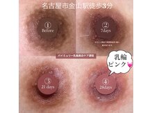 クレア(crea)の雰囲気（メラニンケア#バイミュリー★モニター様20%OFF）